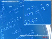 MRSA on oxacillin resistance screening agar